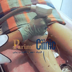 جدیدترین دستگاه لاغری موضعی لیپوسونیکس