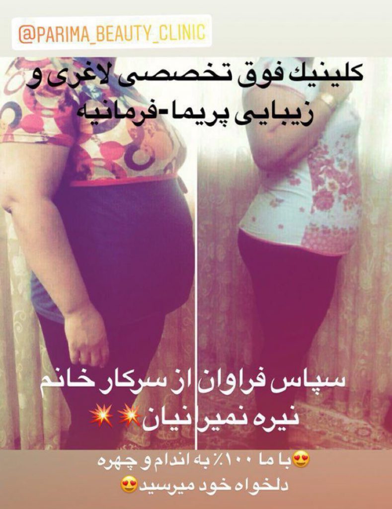 لاغری با دستگاه