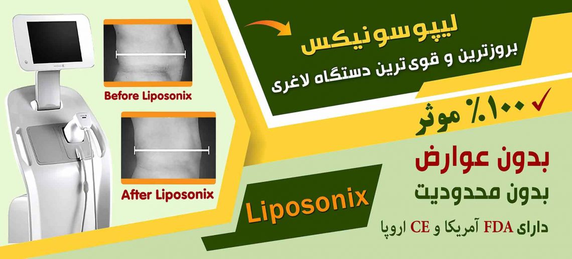 لیپوسونیکسلیپوسونیکس جدیدترین دستگاه لاغری